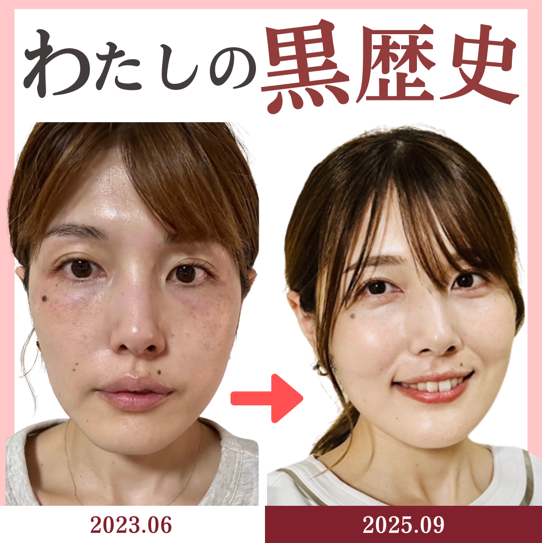 わたしのビフォーアフター写真