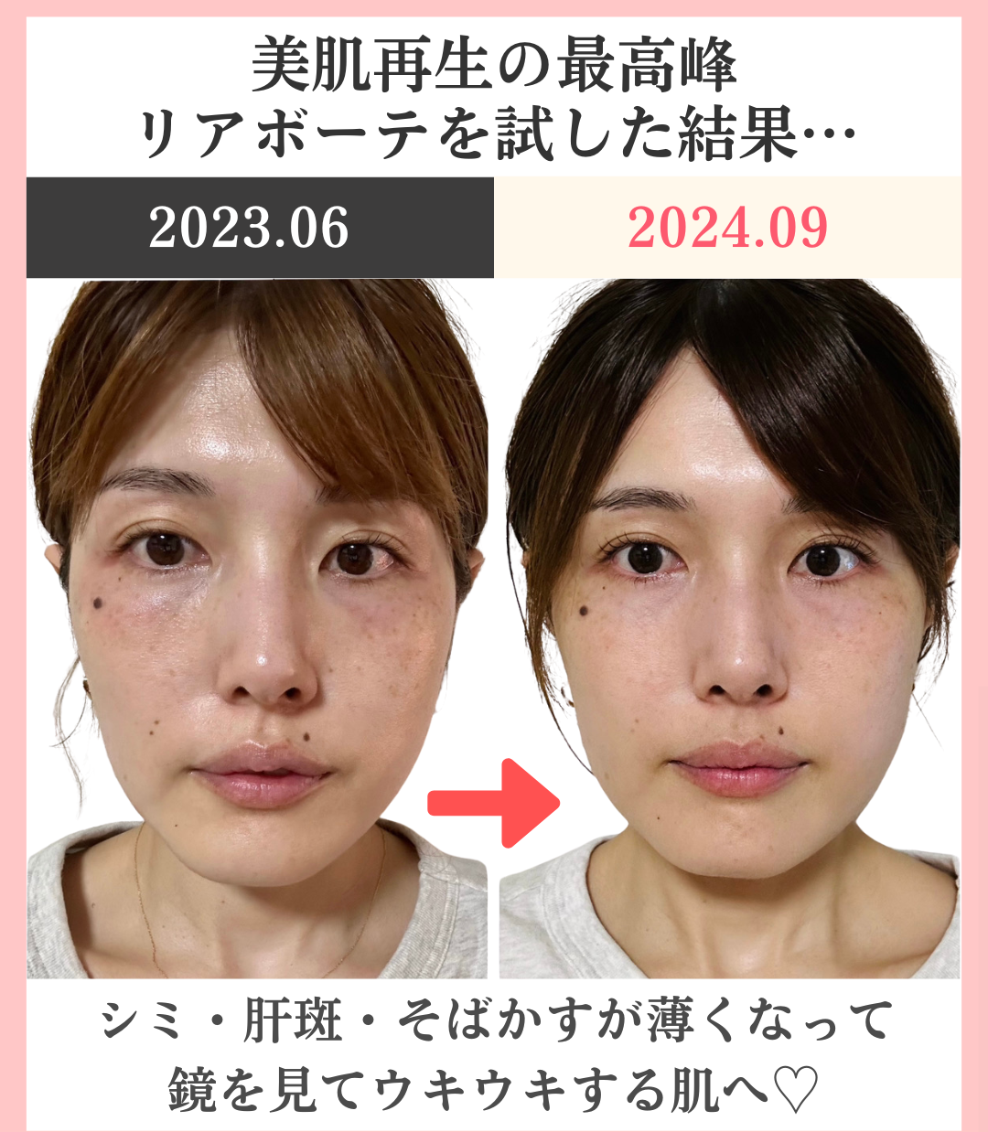 １年目のビフォーアフター写真