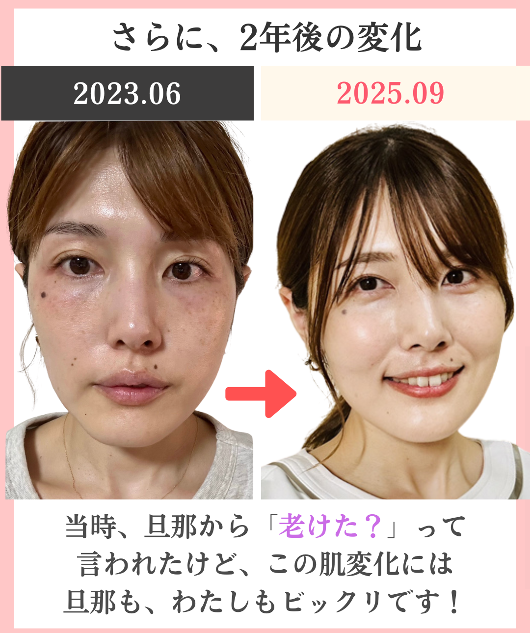 ２年目のビフォーアフター写真