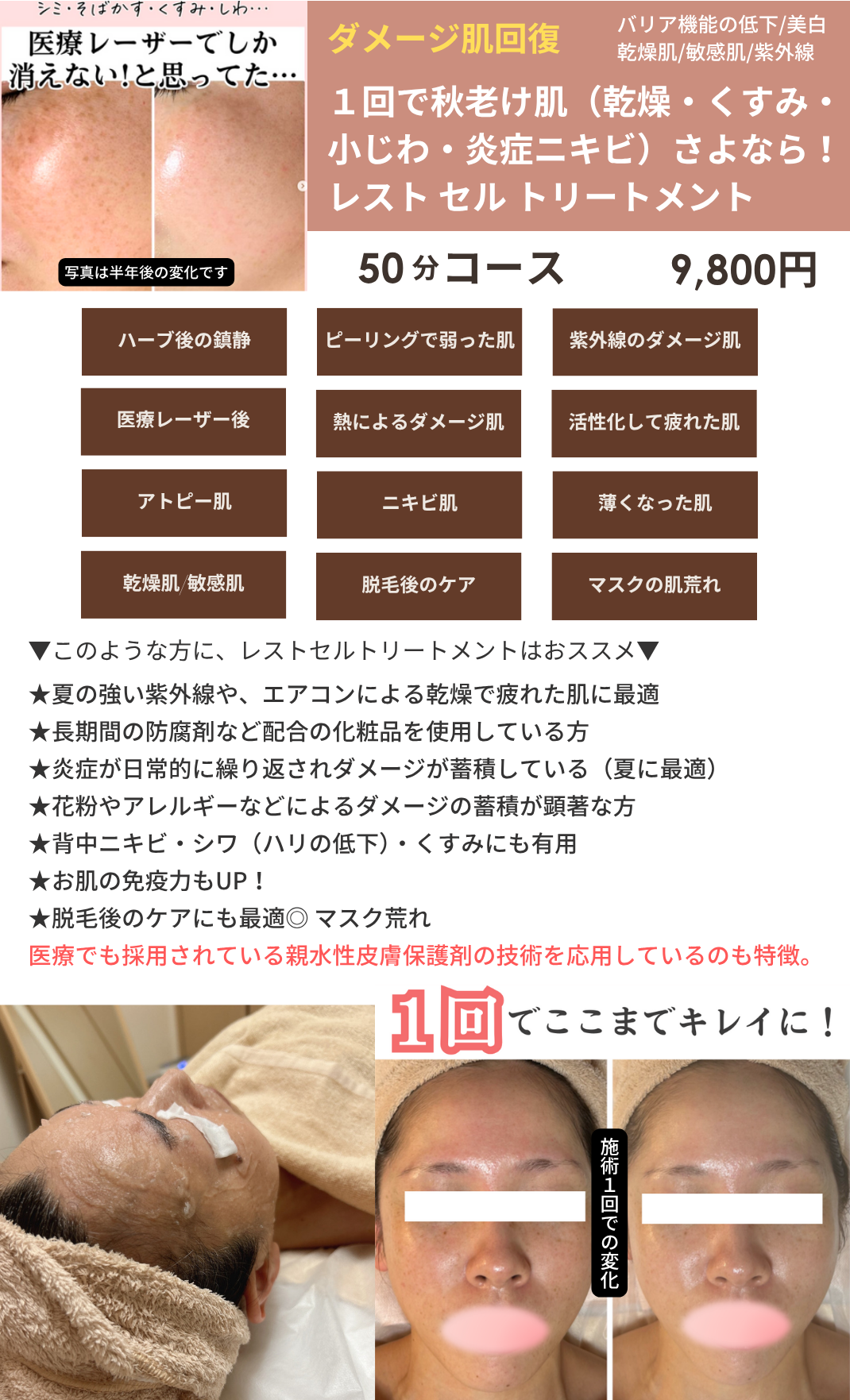 レストセルトリートメントの画像