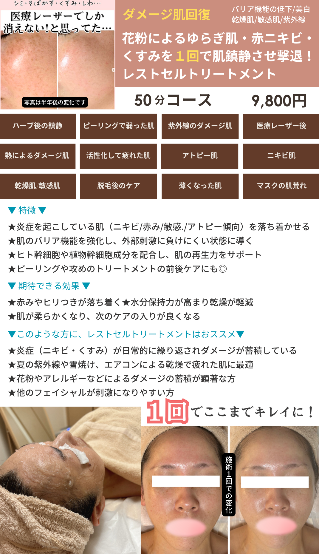 レストセルトリートメントの画像