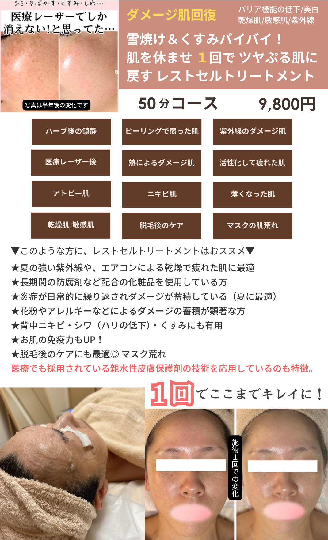 レストセルトリートメントの画像