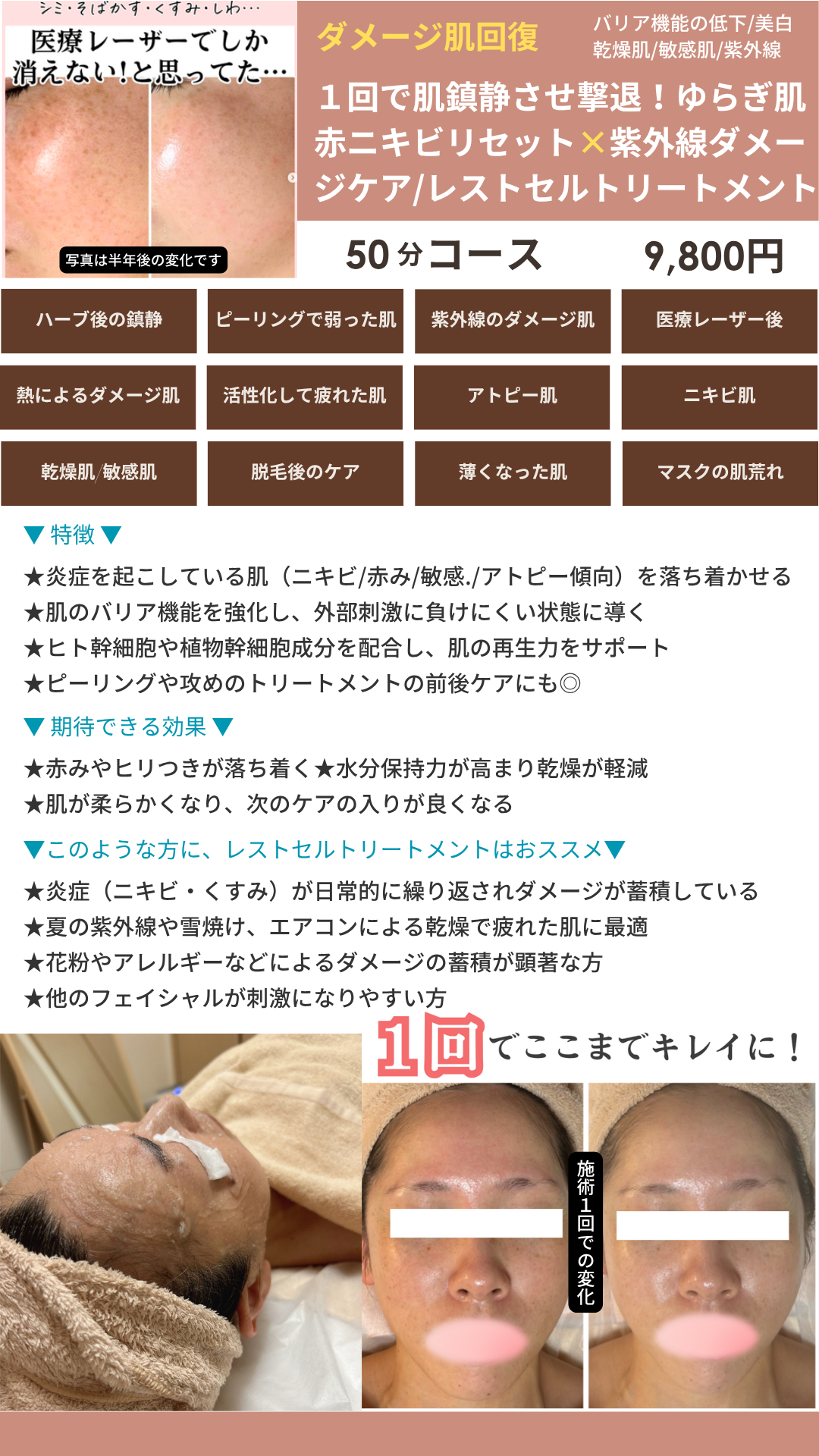 レストセルトリートメントの画像