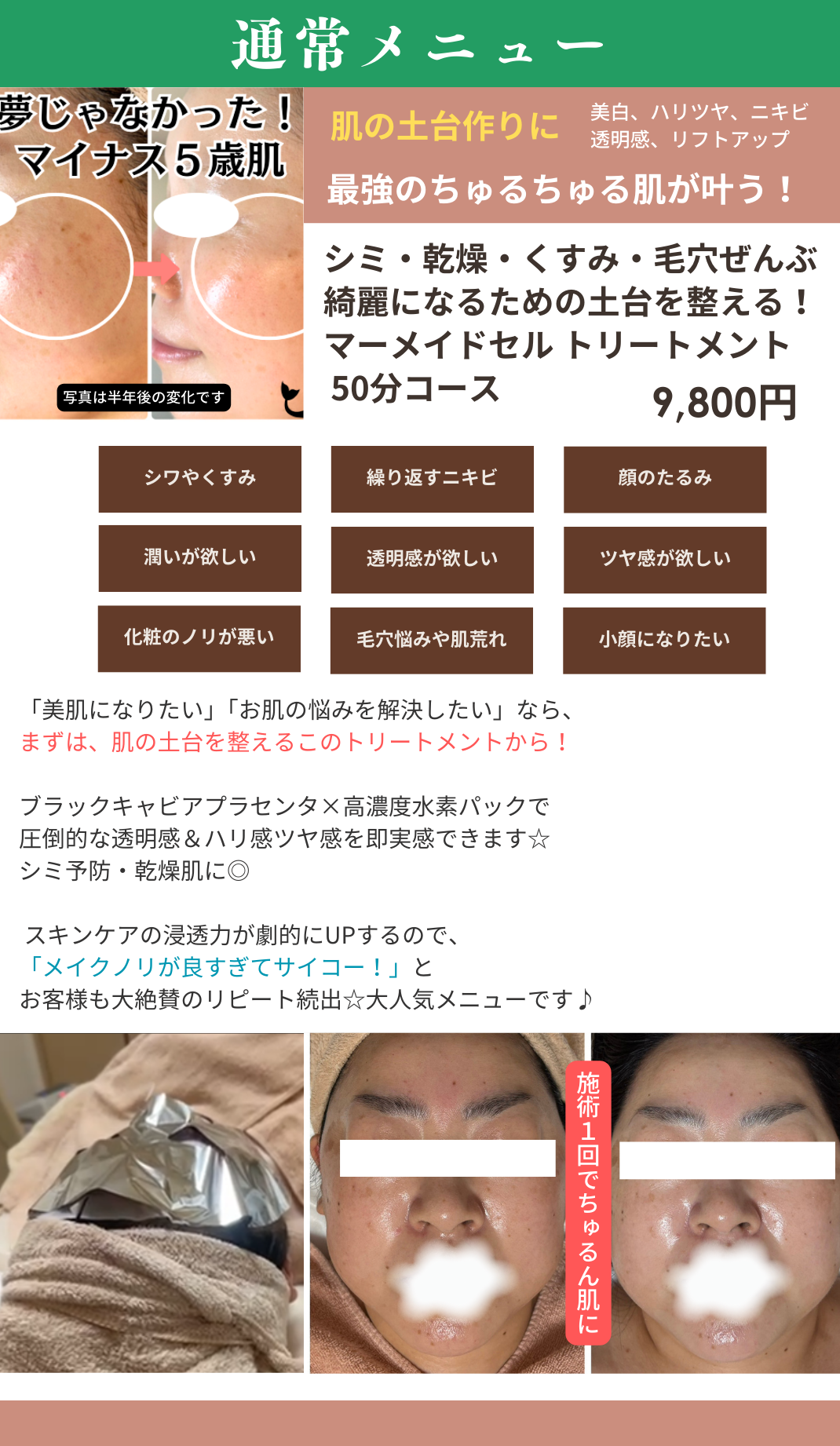 マーメイドセルトリートメントの画像