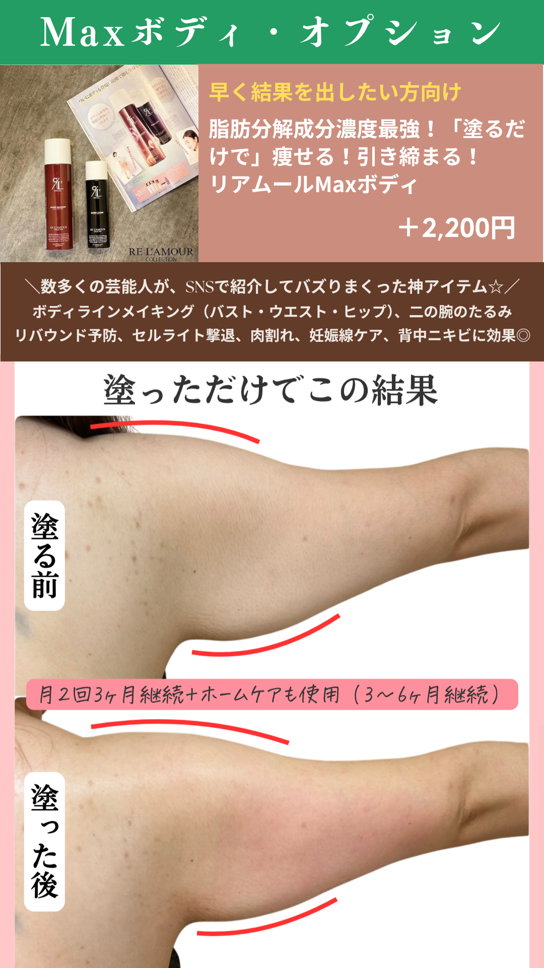 オプションの画像