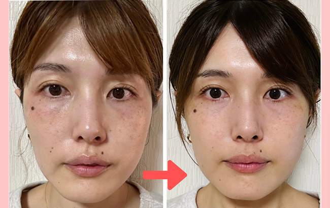 リアボーテを使ったビフォーアフター画像