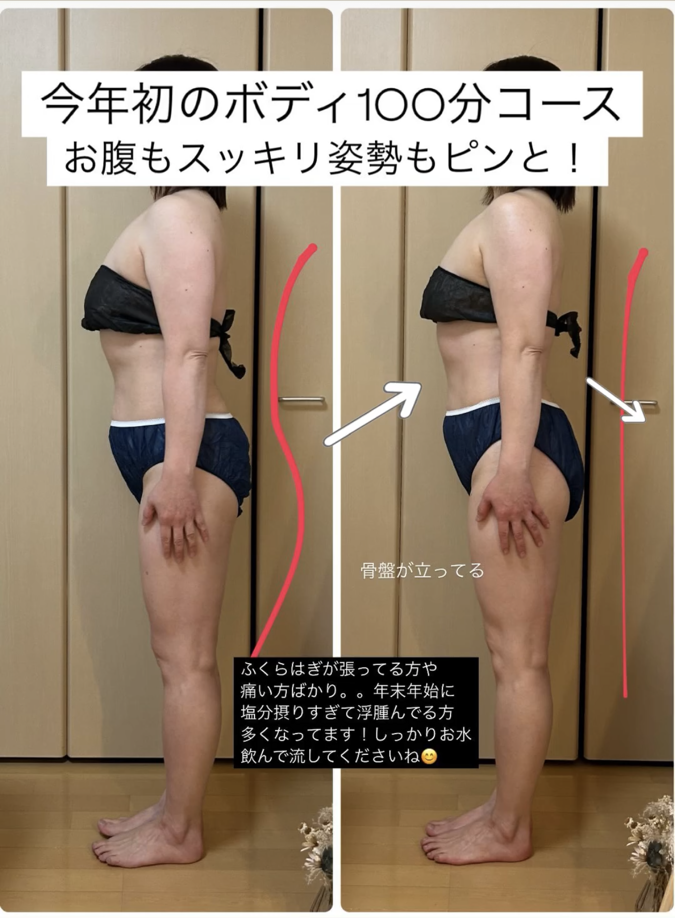 浮腫みと、ふくらはぎの張りがある方