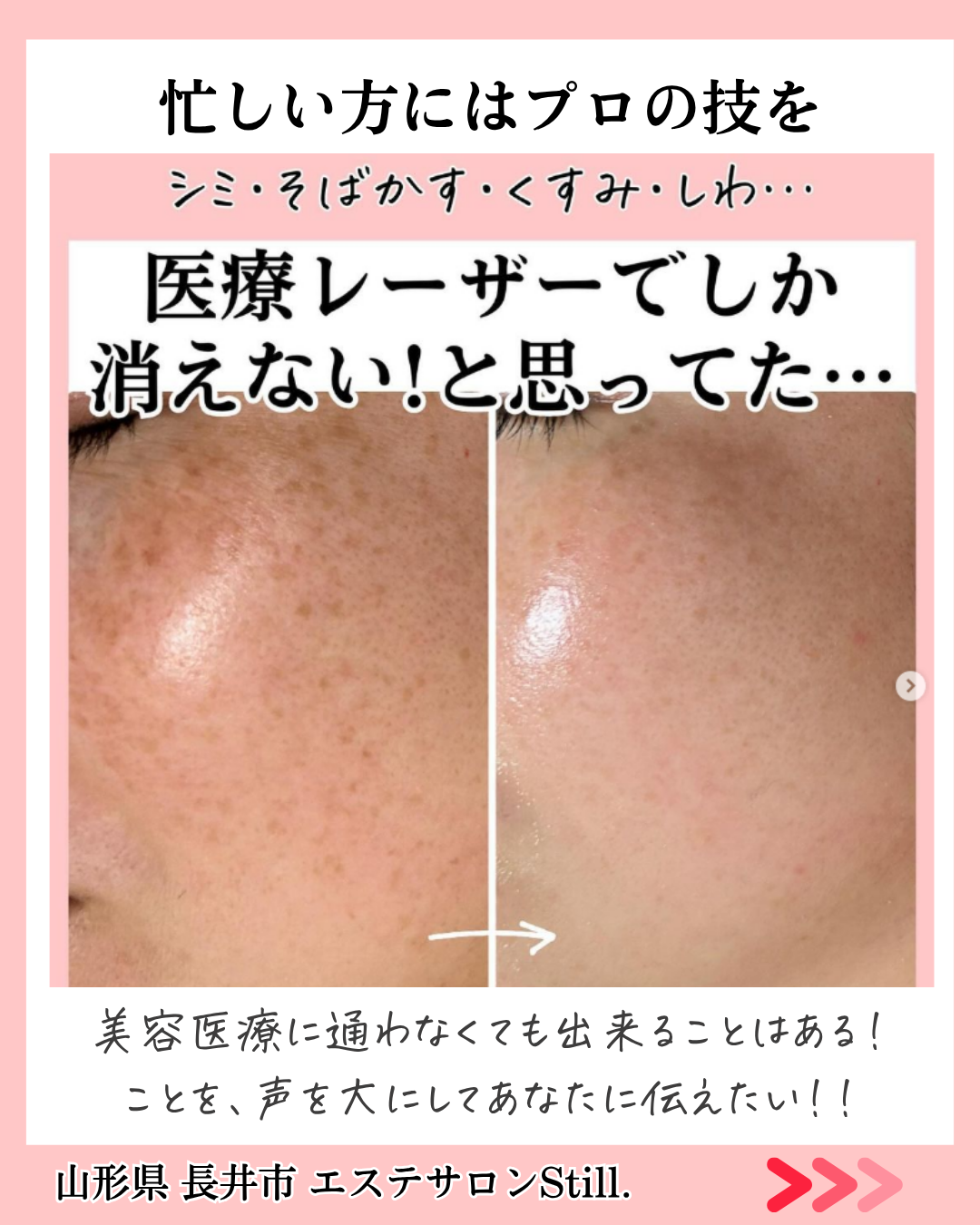 美肌になれた写真