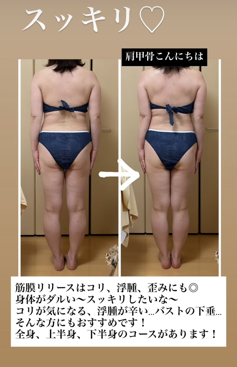 背中がスッキリ痩せたビフォーアフターの写真