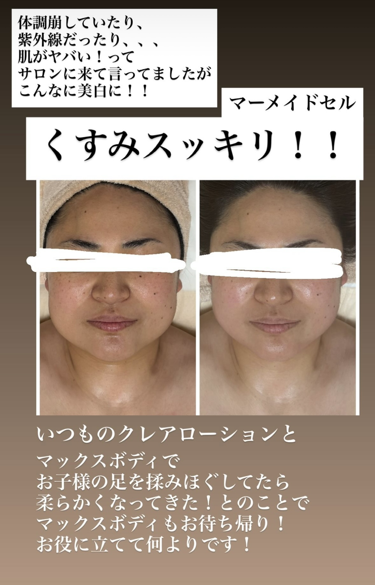 肌のくすみのビフォーアフター画像
