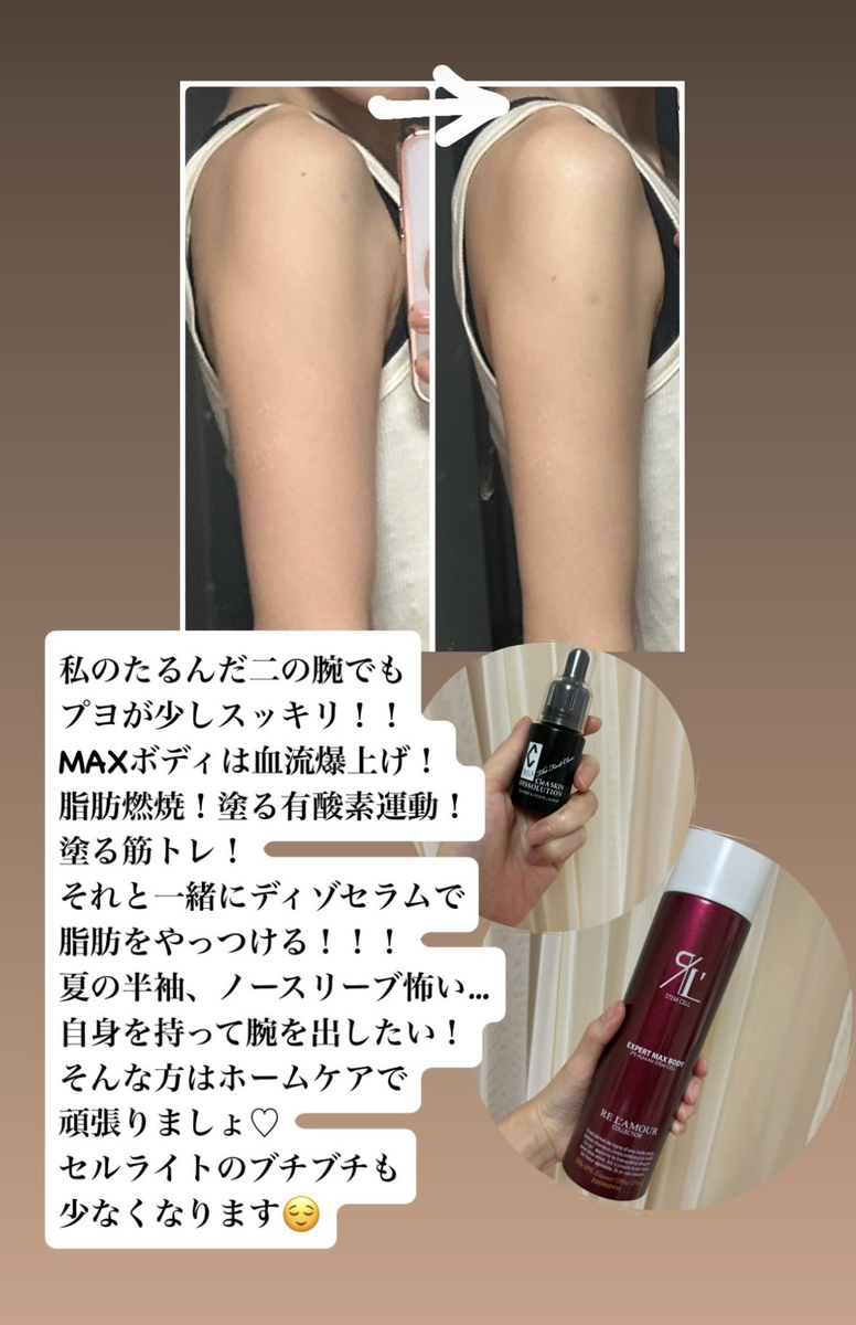 リアボーテマックスボディを使って二の腕のたるみが改善した画像