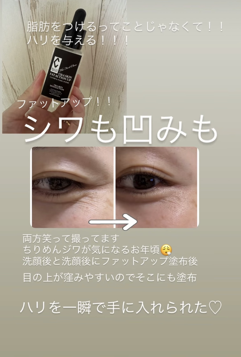 ビフォーアフター写真