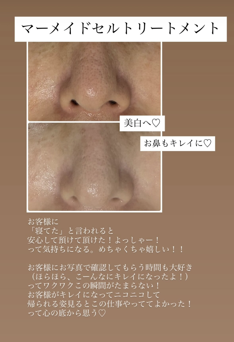 ビフォーアフター
