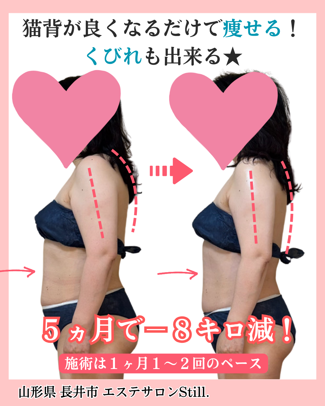 お客様のビフォーアフター横からの写真
