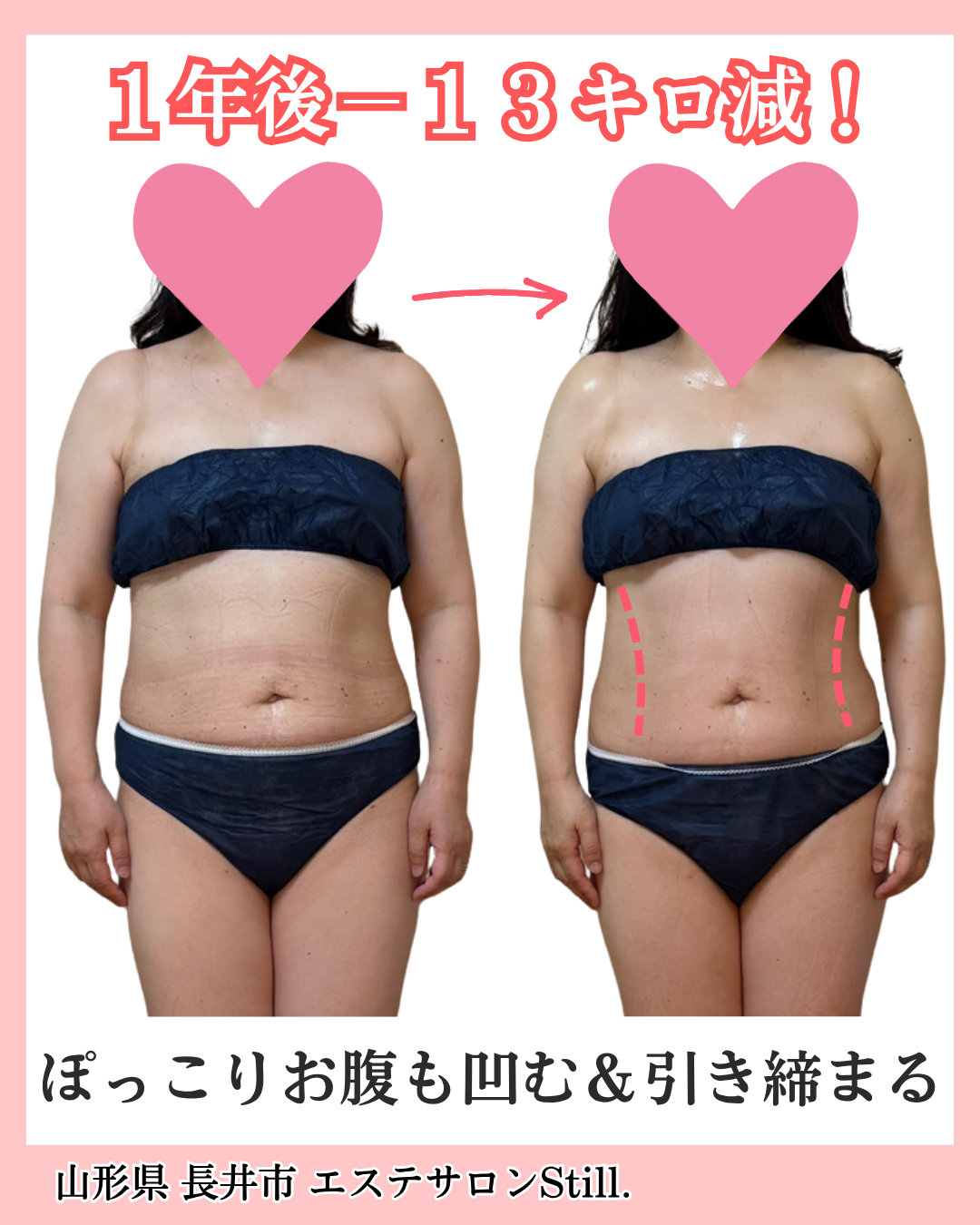 お客様のビフォーアフター真正面の写真