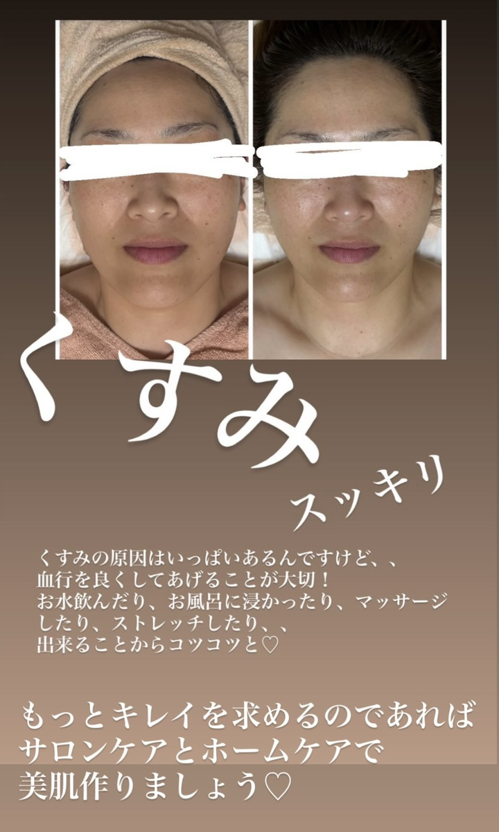 肌のくすみのビフォーアフター
