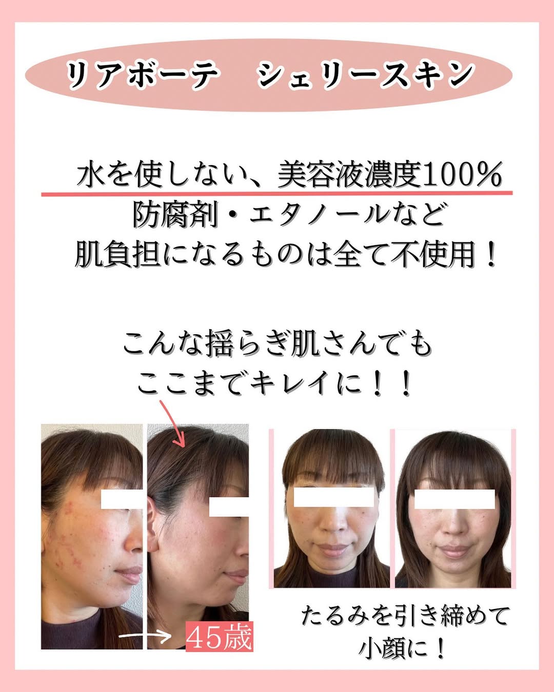 45歳女性のビフォーアフター
