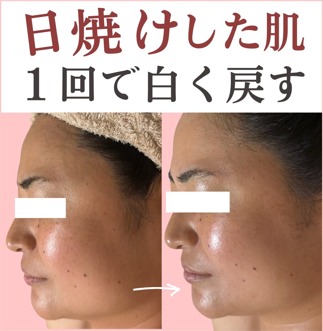 ビフォーアフター横から見た画像