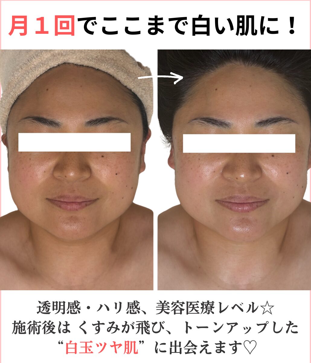ビフォーアフター真正面