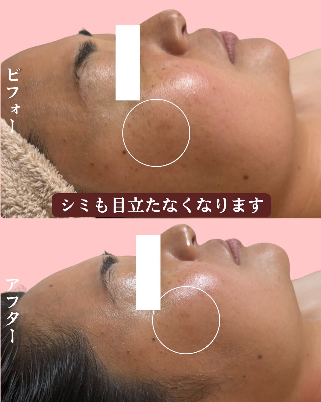 ビフォーアフター右側