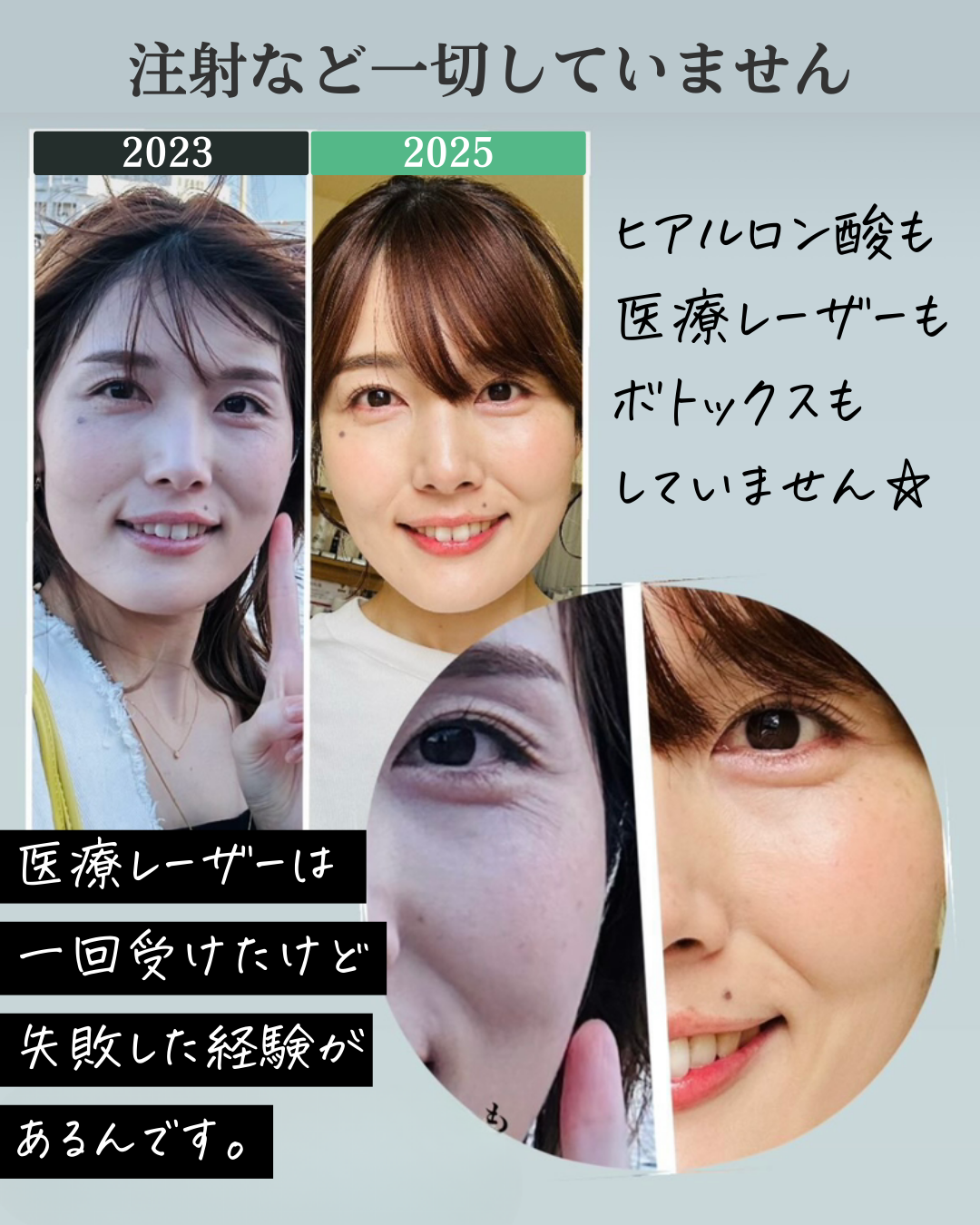 わたし自身のビフォーアフター画像１