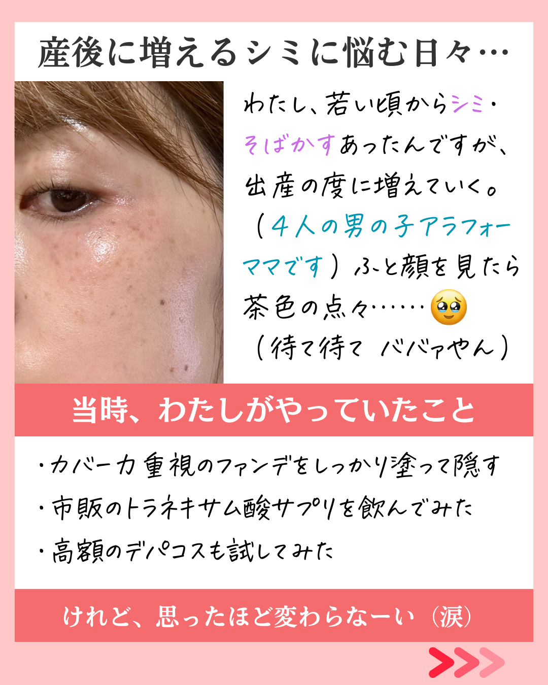 わたしのビフォーアフター