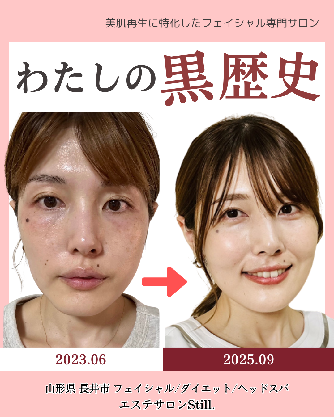 わたし自身のビフォーアフター画像