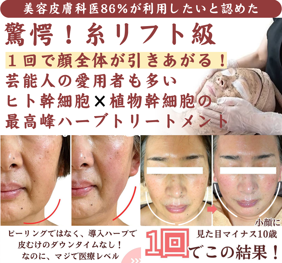 １回で顔全体が引きあがる！芸能人の愛用者も多いヒト幹細胞×植物幹細胞の最高峰ハーブトリートメント