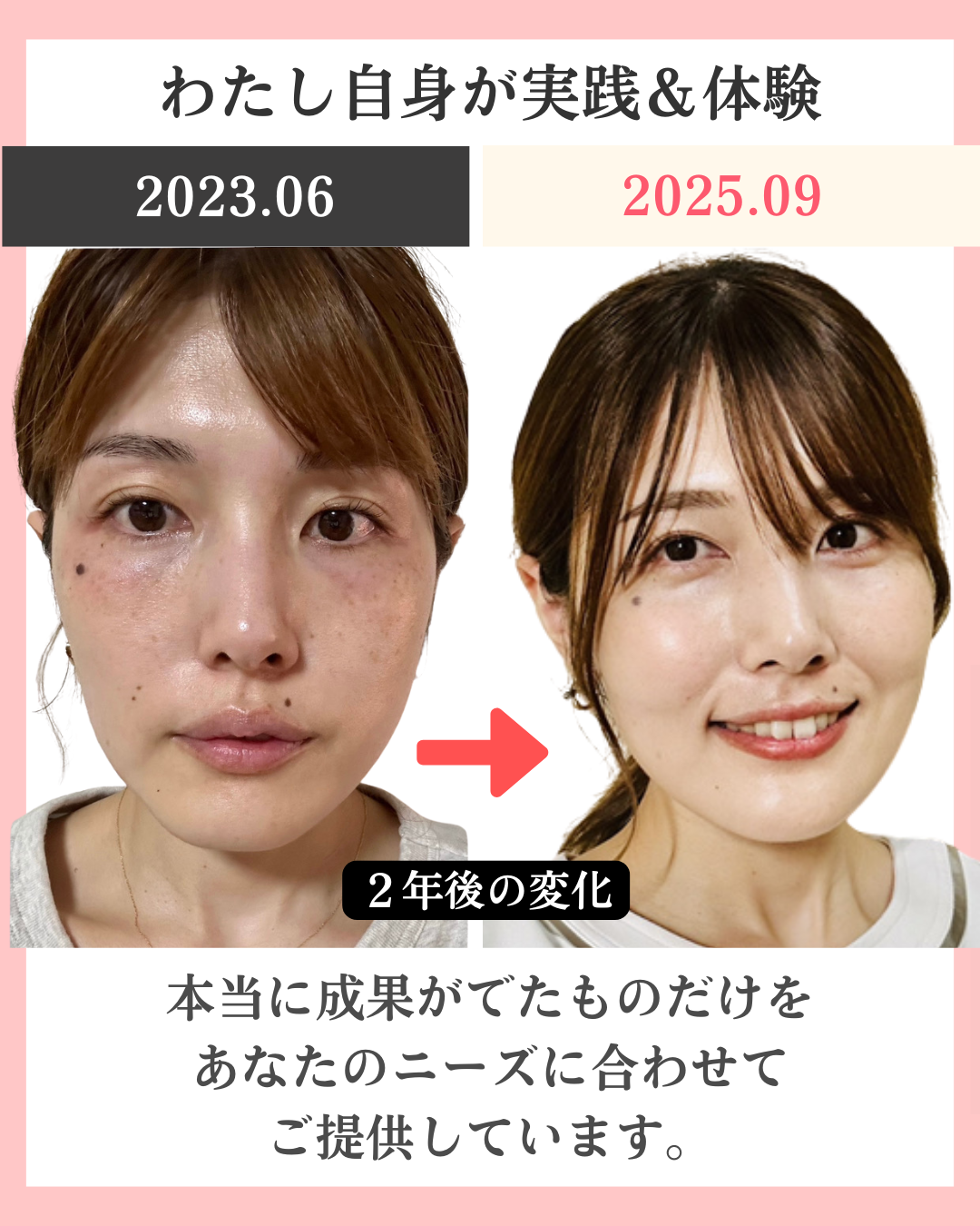 わたしのビフォーアフター