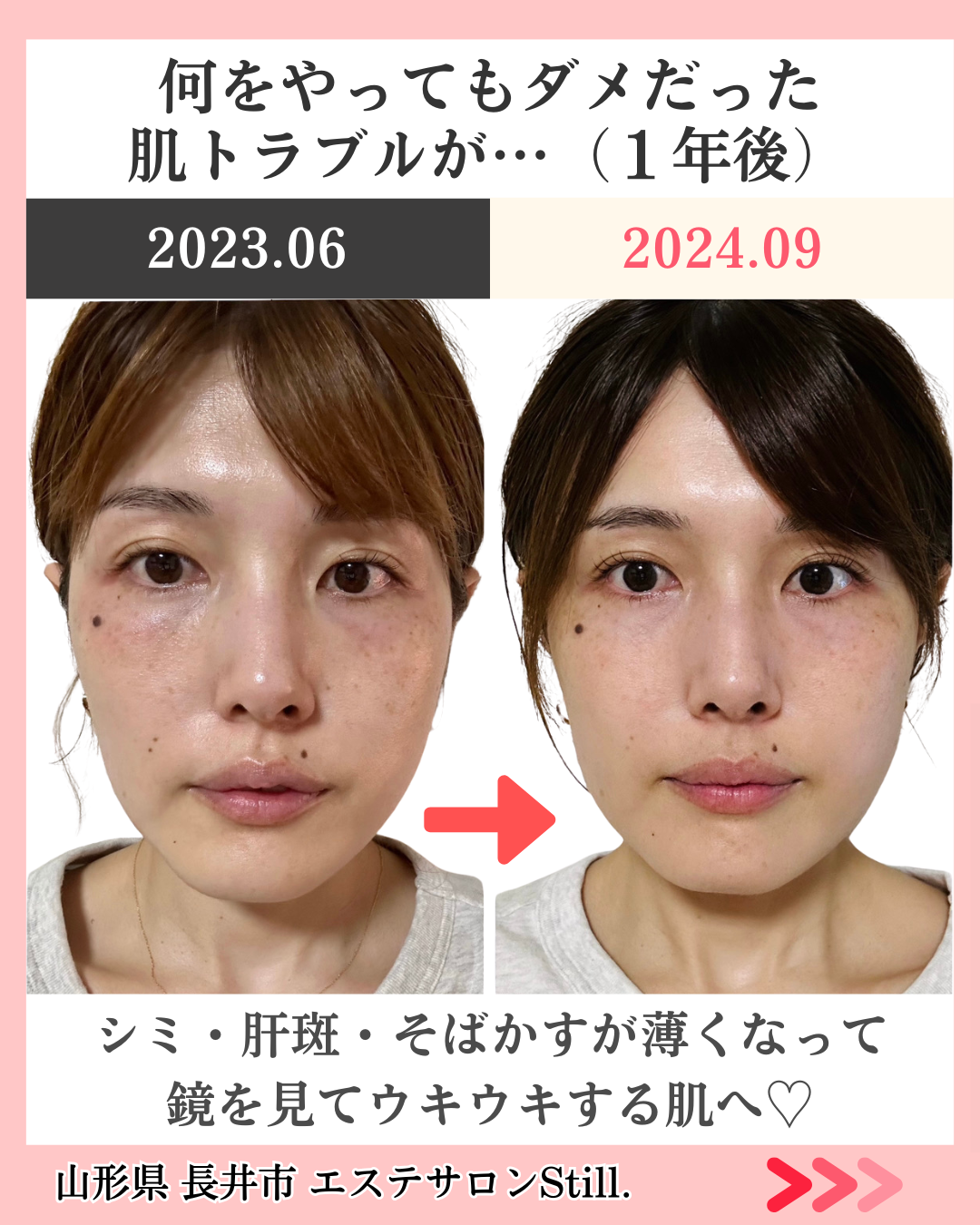 ビフォーアフター