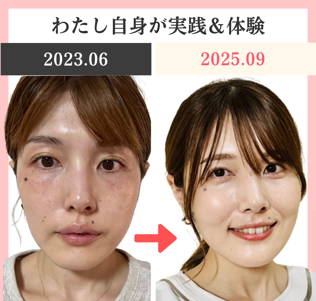 リアボーテを使って２年間の変化