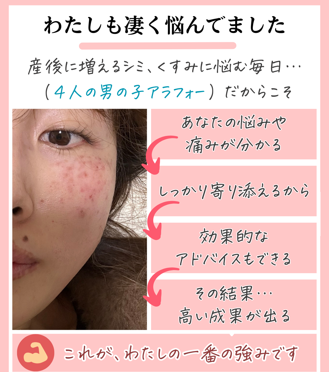 当サロンで肌質改善する１番の理由