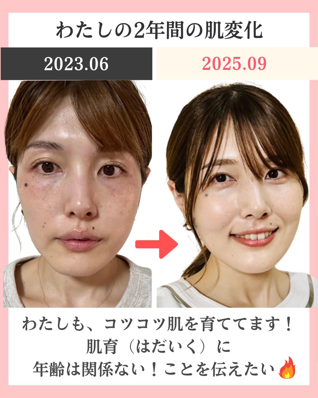 わたしのビフォーアフター画像