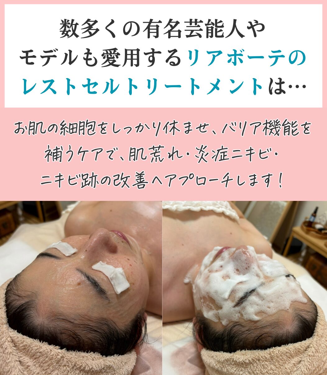 レストセルトリートメントの特徴を解説した画像