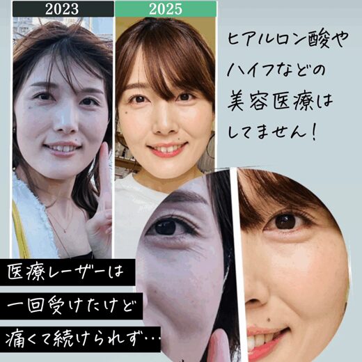 わたしのビフォーアフター写真