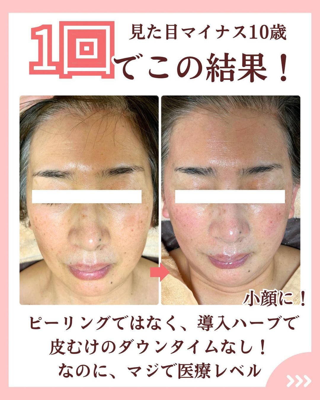 ハーブトリートメントのビフォーアフター写真