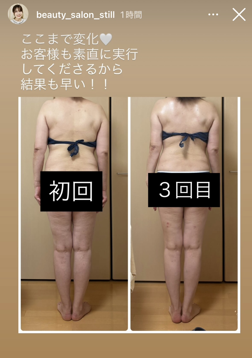 ダイエットのビフォーアフター