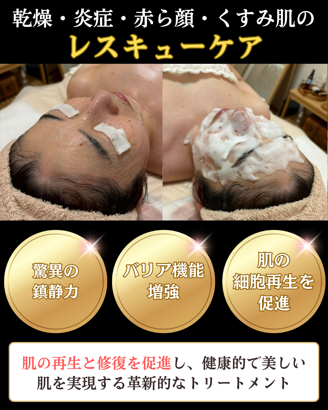 レストセルトリートメント
