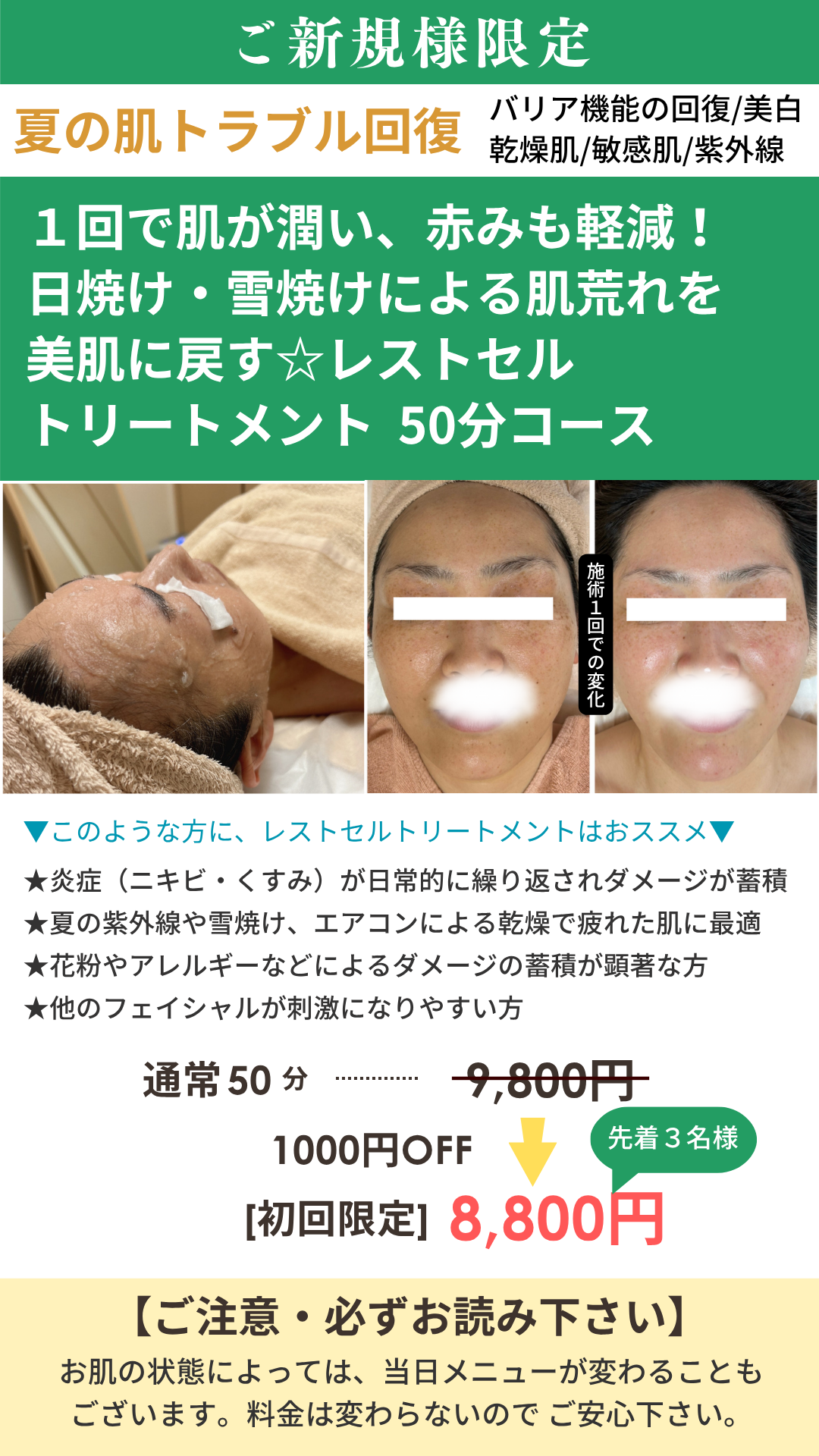 レストセルトリートメントの画像