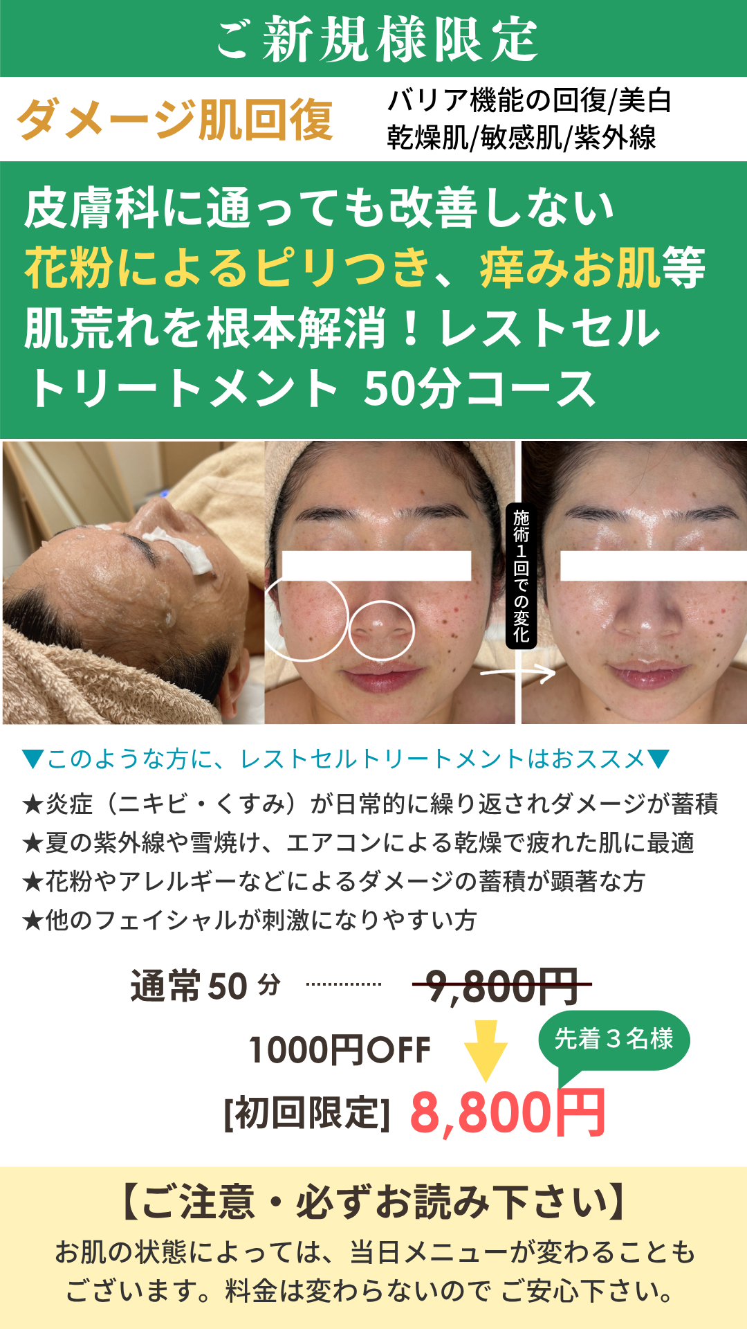 レストセルトリートメントの画像