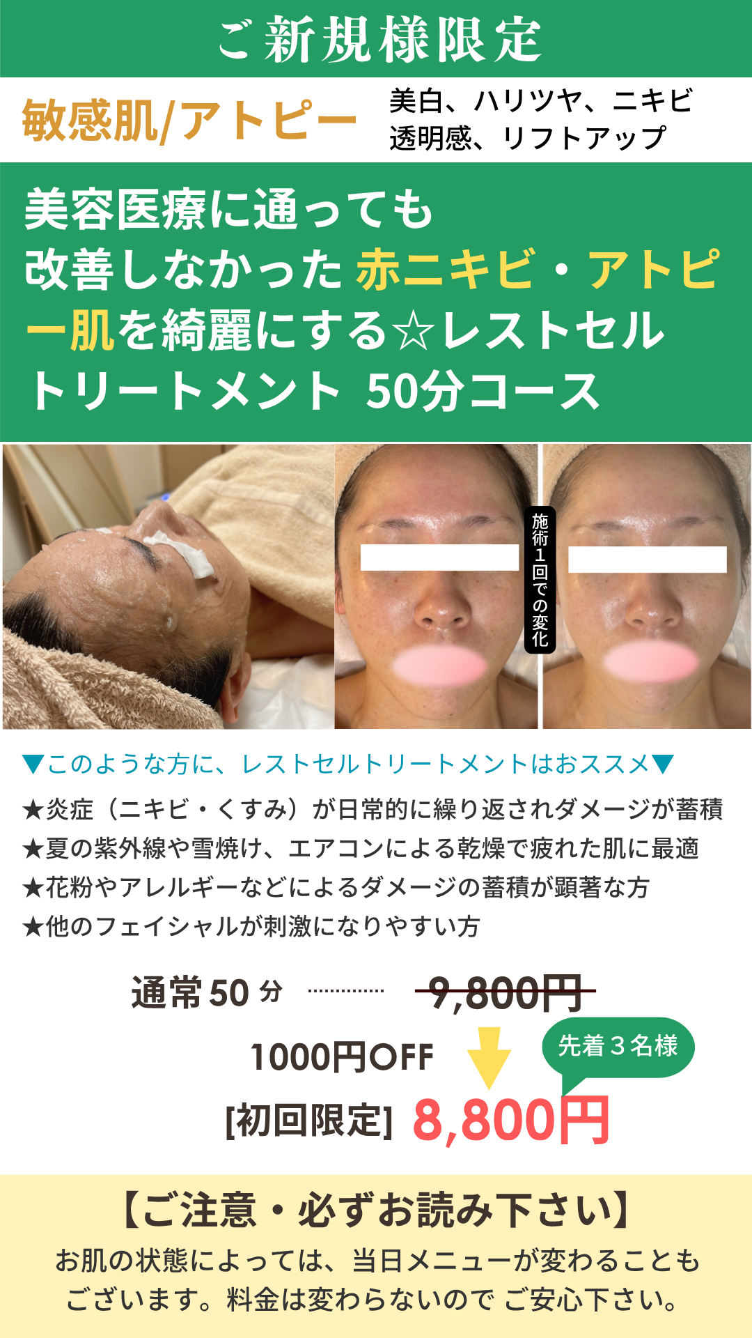 レストセルトリートメントの画像