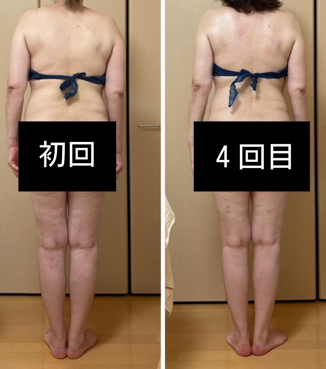 ダイエットのビフォーアフター