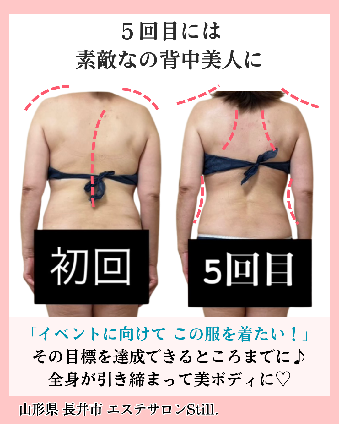 ダイエット５回目のビフォーアフター画像