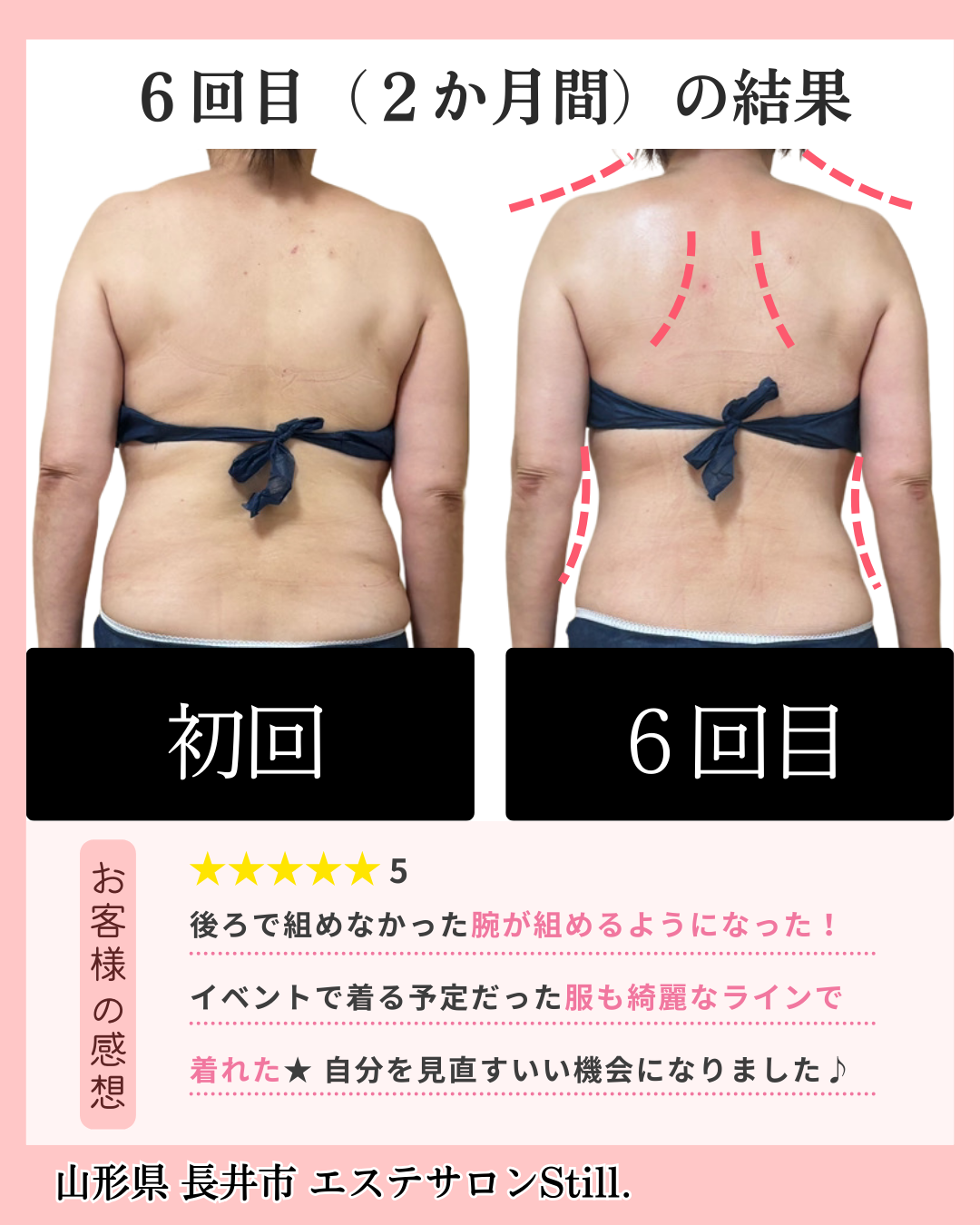 ダイエット６回目のビフォーアフター画像