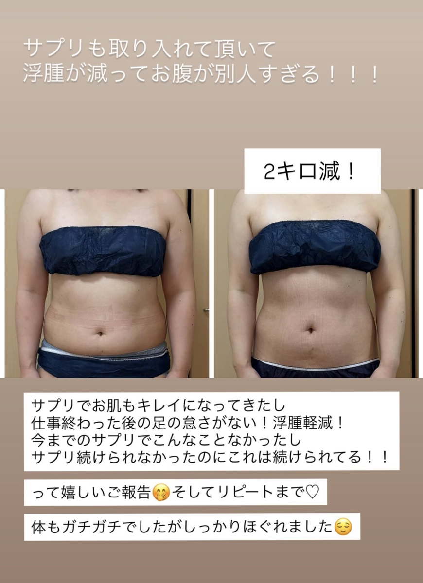 30代後半女性のお腹周りのダイエットビフォーアフター