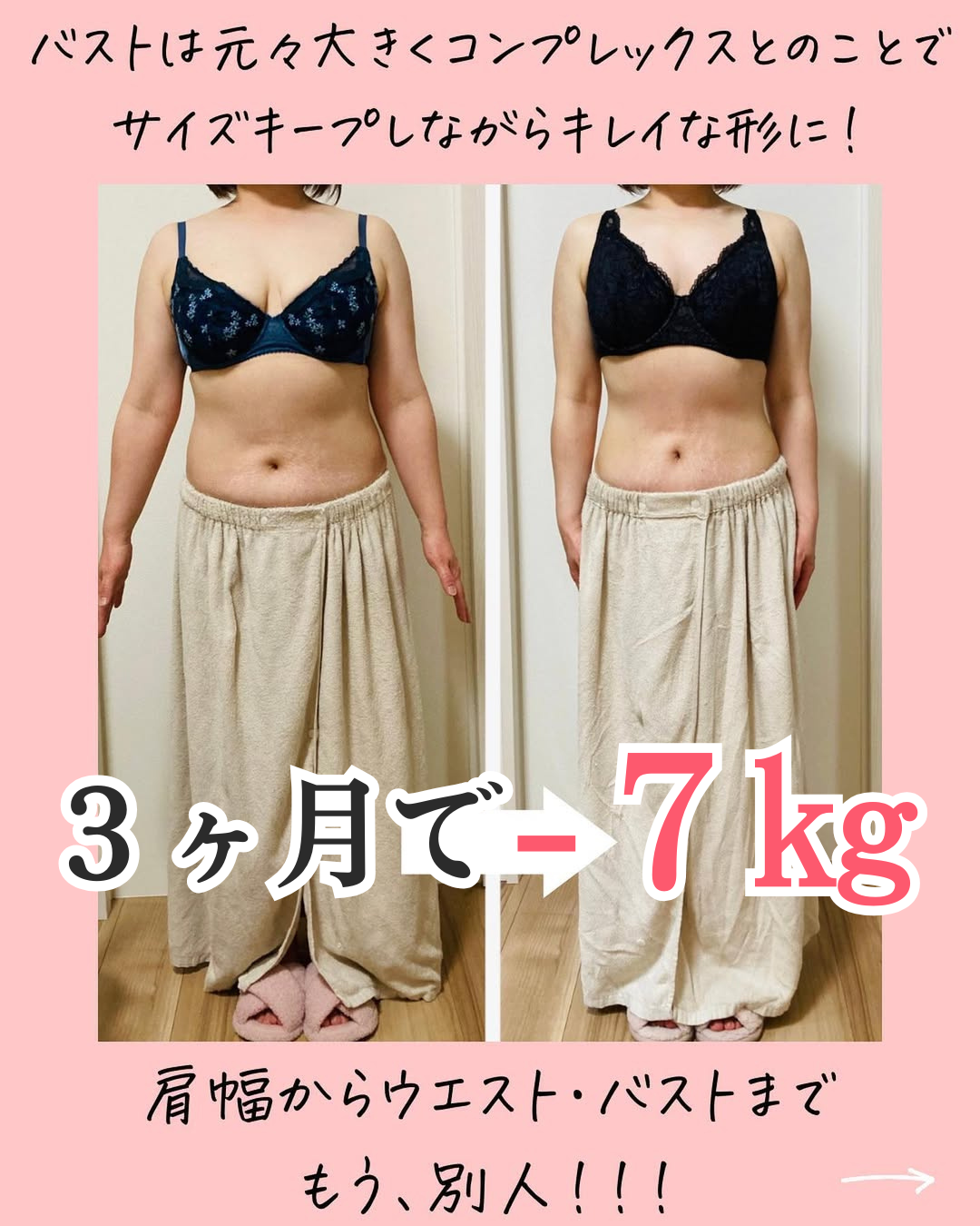 50代ママのビフォーアフター画像：真正面