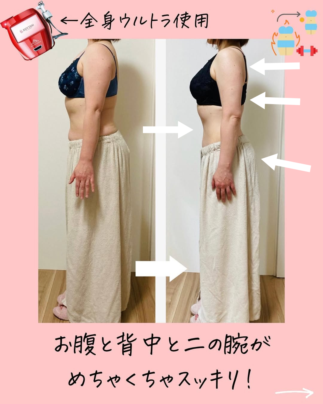 50代ママのビフォーアフター画像：横から見た姿