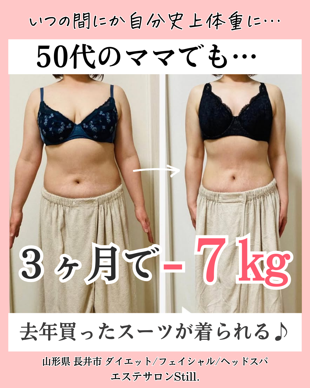 50代女性が３ヶ月で７キロ痩せたビフォーアフター真正面からの画像