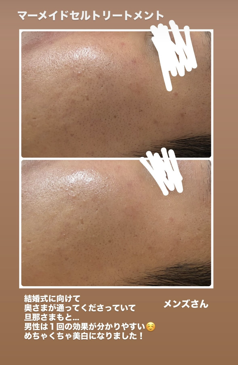 旦那様のビフォーアフター