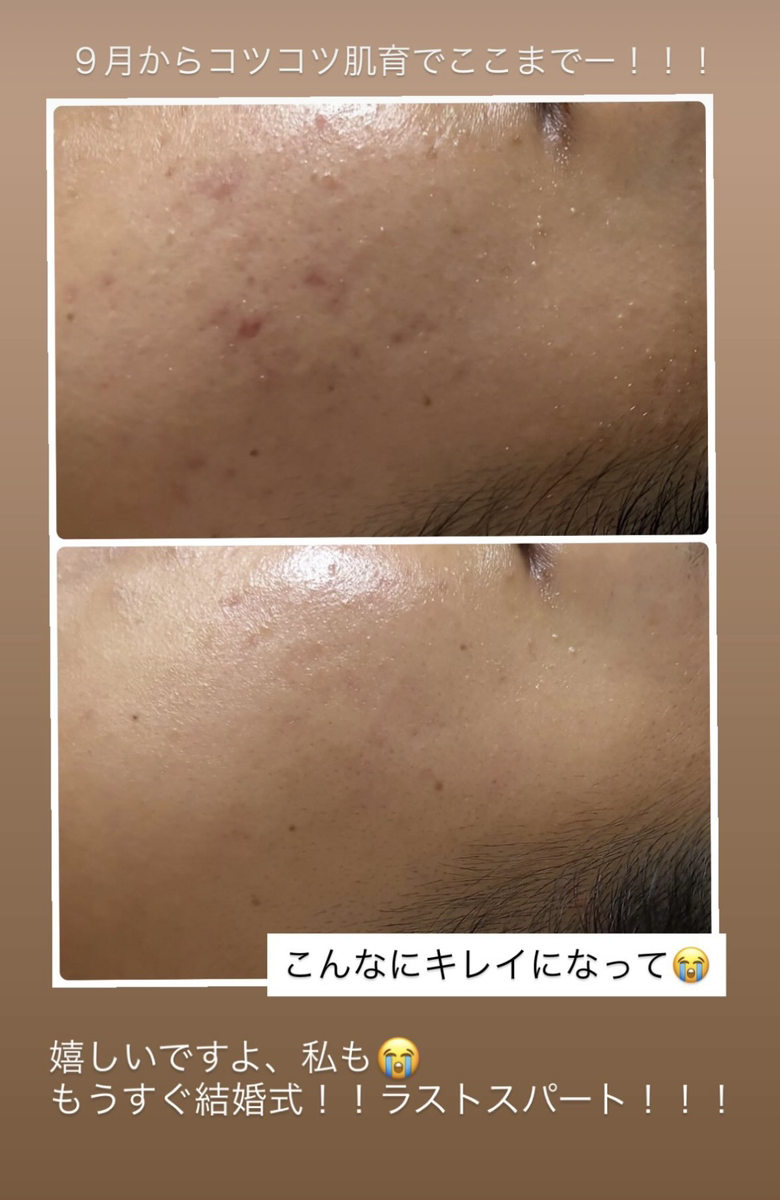 ７か月目のビフォーアフター